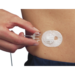 Cateteres e Reservatórios para Bomba de Insulinas