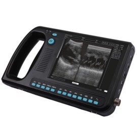 Ultrasom Scanners Portáteis